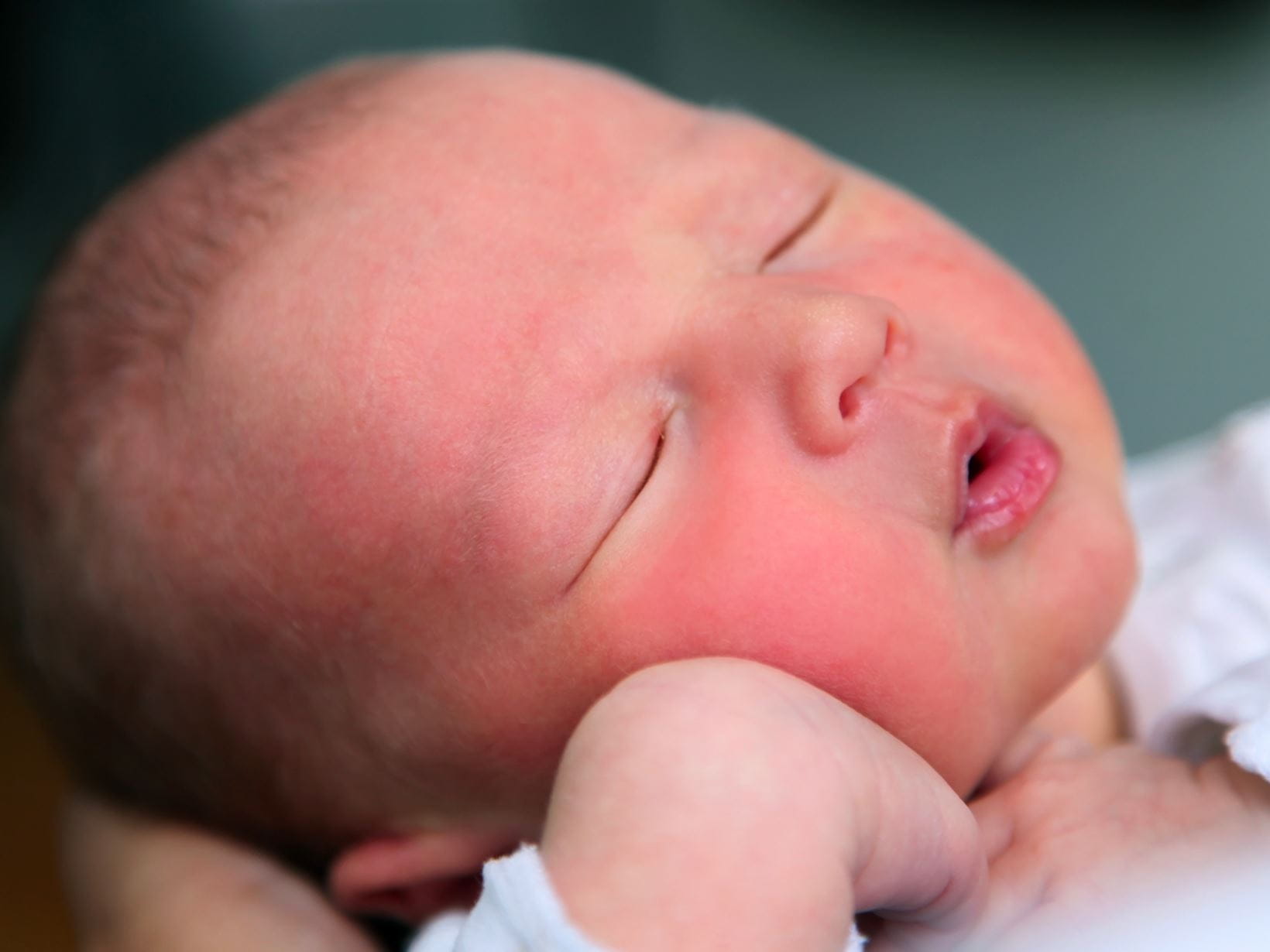 guance rosse nei bambini: perché
